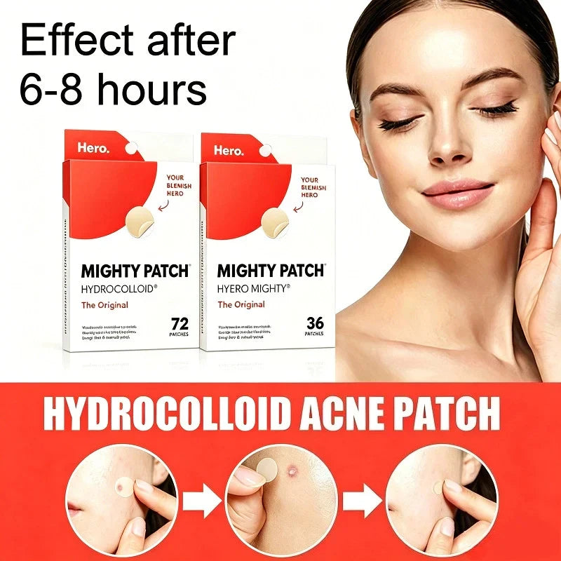 Hydrocolloid Acne Patch